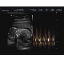 해인한의원 | 해인부부한의원 해인감비환 내돈내산 한약 다이어트 한달복용 후기