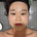 장승배기점 - 승모근관리, 림프순환관리로 매끈해진 어깨와 리프팅된 얼굴 후기(비포 애프터 사진 첨부)