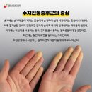 충북수지 네이버블로그