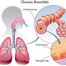 에스케이메디케어 이미지