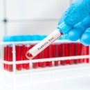 주홍코리아 이미지