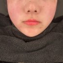 바디채널 수완점 | 광주 수완지구 신부관리 예라인에스테틱 광주본점 온다업프팅 후기