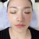 뷰티센터(상록수점) | 안산에스테틱 민뷰티 안산점 피부관리 전문점 마이크로젯 케어 받고 피부 되살림 솔직 후기