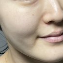 라온메디케어 이미지