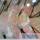 두피연구소(S.lab) 이미지