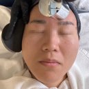루카스올케어뷰티 | 정자동 피부관리 올뉴뷰티 정자점 피부도로공사 여드름 솔직후기