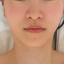 도란도란동물병원 | [수원 광교] 가온라인테라피 : 광교피부관리 에스테틱 윤곽관리 솔직 후기