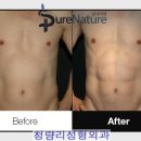 네이처성형외과 이미지