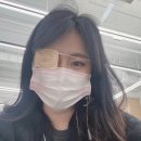 모세안과의원 | 다래끼 짼 후기. 째지마세요..ㅠㅠㅠ (다래끼 짼 후 렌즈, 화장, 붓기 등)