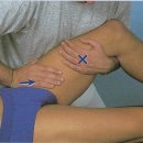 (치료)Hip joint caudal gliding(abduction)-책에 없음 견인시됨 이미지