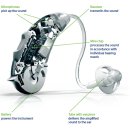 이 보청기 이미지