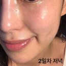 예쁨주의보 | 신논현 예쁨주의보에서 받은 ‘필로드’ 스킨부스터 후기