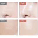 NP 컨디셔닝 이미지