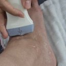 아이메디케어 이미지