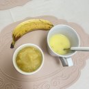 새희망병원 | 평택 굿모닝병원 담석증 담낭절제술 5개월 경과 후기 (식단, 증상, 꿀팁 등)