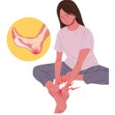 셀프 건강마사지(이론) | [새솔동 재활운동] 족저근막염에 좋은운동과 실제 교정운동 후기