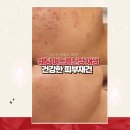 아루아 에스테틱 | 동탄피부관리 화성 청계동 아루아에스테틱 위치 가격 후기 추천
