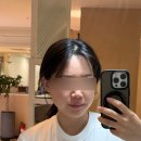 메디시스템 | 대전 피부관리샵 데자뷰메디스킨 아쿠아필 수분관리 솔직후기
