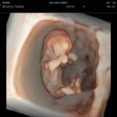 강내동물병원 | [11-14주차 일상] 13주차 입덧 사라짐..?🙊 임산부 피부과 레이저 치료