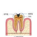 상아치과의원 | 대구칠곡치과추천 충치 치료 &#39;이것&#39; 꼭 확인해 주세요