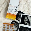 D3 | 임신 중기 비타민D 4000IU 파이토뉴트리 비타민D3 솔직 후기