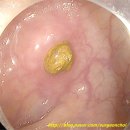 안산여인숙 이미지