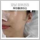 무아 플레이스 강남 피부관리 스킨플래닝 플라즈마 | [강남피부관리] 무아플레이스 강남 세라링 스킨플래닝 후기