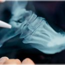 운동처방재활 이미지