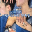 [창원예신관리] 피부미용기기 예담에서 볼뉴업 관리로 예신관리 시작하기