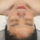 [안동미용] 경북 안동 옥동피부관리샵 추천 '미앤미' 얼굴 기본관리 수분+미백 케어 후기