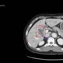 통합요양병원 이미지