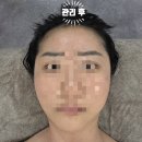 벨르 | 내 피부관리와 얼굴경락, 부천 '벨르바디' 맞춤 관리 후기 (리프팅 효과 대박!)