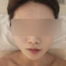 비엔비메디칼 | 신월동 피부관리실 비비에스테틱 탄력 써마X 후기
