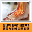 류마제통의원 | 발가락 통증 병원 안내 대구 류마티스내과