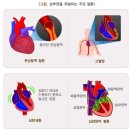 5대 심장질환 분류표[별표-질병관련18][[통합간편]5대 심장질환 진단비 특별약관] 이미지