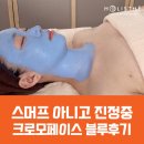 [홀리스떼생생후기] 진정진정~! 크로모페이스 블루 관리후기