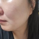 더푸른약국 | 약국에서도 만날 수 있는 약국템 VT 약국 PDRN RX3종 후기