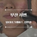 뷰티더그레이스 | 부산 범내골 피부관리 :: 뷰티더그레이스 서면점, 여드름관리 솔직후기