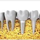 서울샘치과의원 이미지