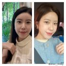 청담셀의원 | 줄기세포피부주사 (청담 하이엔드부스터 ) 후기