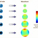 왕눈이안경원 | "우리 아이도 근시억제렌즈를 사용하고 있는데 왜 시력은 계속 떨어지나요? (feat. 똑 같은 임플란트도...