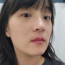 유림-1146 | 서면 입술관리 도이뷰티 스튜디오 서면점에서 입술 혈색,보습,볼륨까지 다 잡고 온 립톡 비포애프터 후기