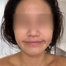 씨유 김포구래점 | 구래동피부관리 : 후에스테틱 하이푸 물방울 관리 후기