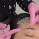 김두지헤어라인 | 화성 M자이마 반영구 헤어라인문신, 레이저없이 눈썹문신잔흔제거 리본브로우에서 성공후기