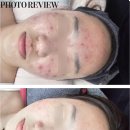 아이셀메디텍 이미지