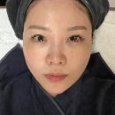 필의원 - 김해시 분성로 230 | [신논현 - OO의원] 라라필 솔직후기