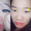 아이그램성형외과의원 이미지