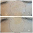 시너지케어메디스 | 영등포 피부관리 해움 에스테틱, 세멘시트 모공+탄력 관리로 피부 나이 되찾기