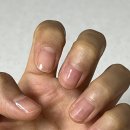 이큐어(주) | 반디 네일큐어 손톱영양제 핑크다이아 사용 후기
