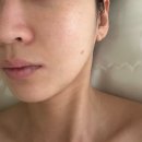 프롬(From)302 | 범계 피부관리 [프롬미 안양범계점] 바이오힐 후기